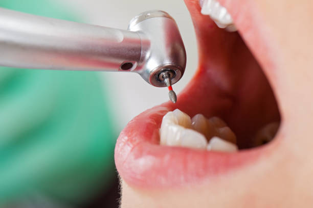 Best Emergency Dentist for Knocked-Out Tooth in Sharon, TN